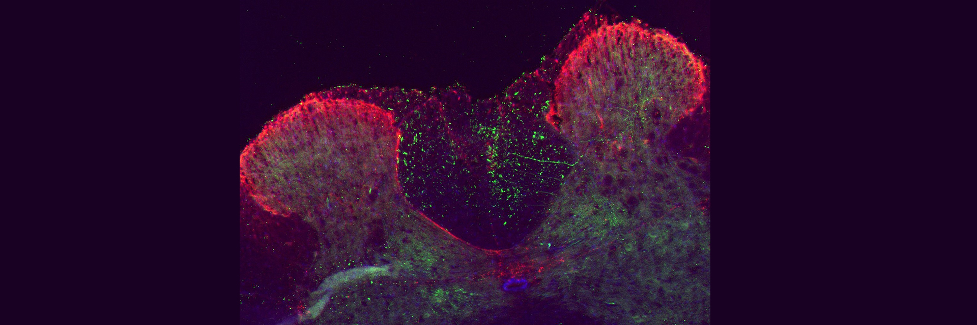 Transveral view of the spinal cord